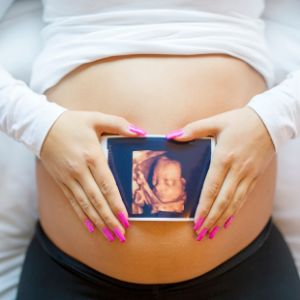 Two Came True | What to expect from prenatal care in twin pregnancy